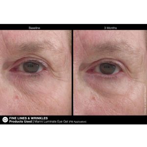 Jan Marini Luminate Eye Gel results