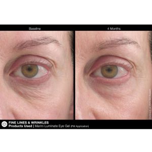Jan Marini Luminate Eye Gel results