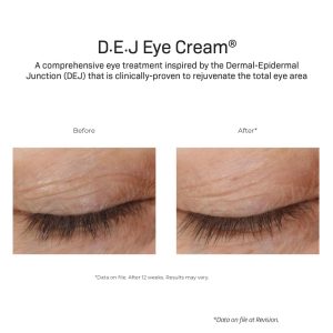 DEj Eye Cream Results after 12 weeks