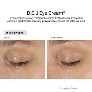 DEj Eye Cream Results after 8 weeks