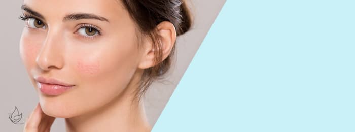 Model with redness in the skin