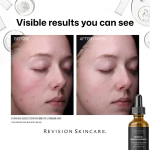 Alternative view of Revision Skincare Radiance+ Overnight Resurfacing Serum