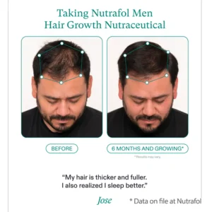 Nutrafol for Men before and after