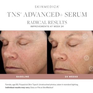 SkinMedica TNS Advanced + results 2