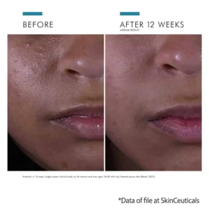 SkinCeuticals Silymarin CF ingredients results on oily skin