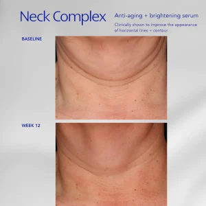 Alternative view of ZO Skin Health Neck Complex Anti-Aging + Brightening Serum