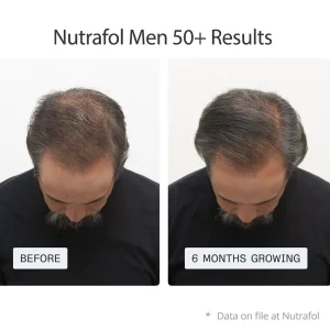 Alternative view of Nutrafol Hair Growth Supplements 3 Month Pack for Men 50+